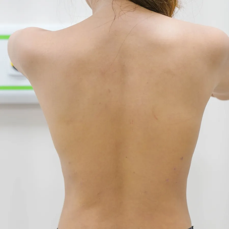 Case 05 — vùng lưng, sau thực hiện