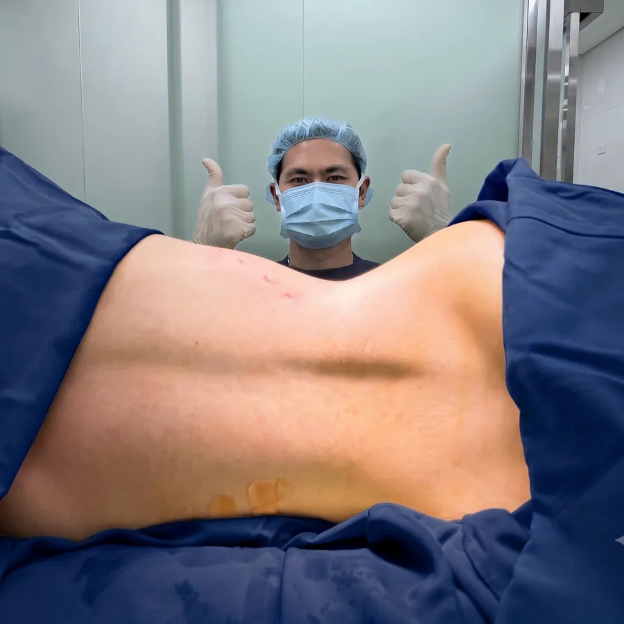 Case 07 — ngay sau phẫu thuật, sau thực hiện